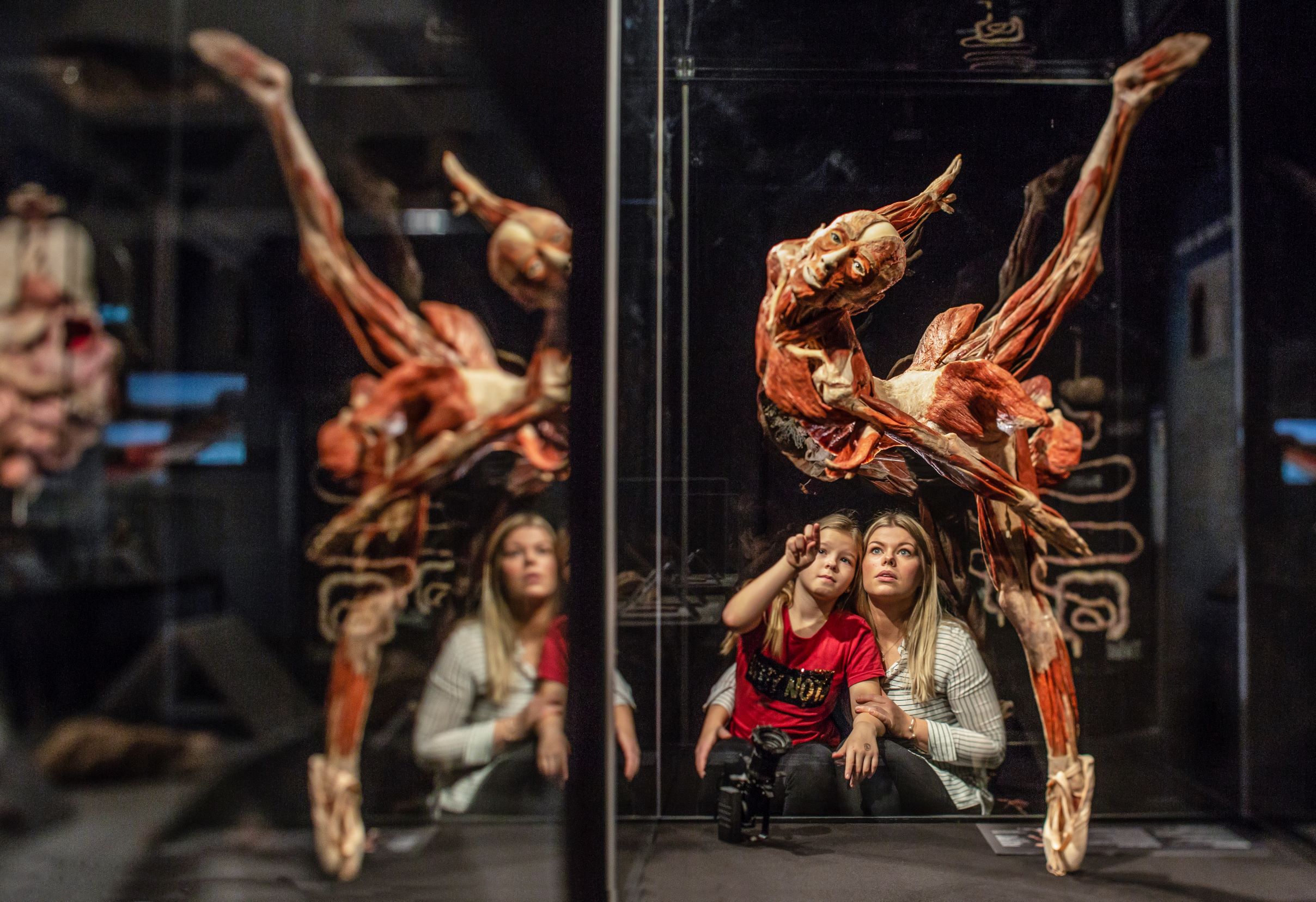 Great Lakes Science Center to open BODY WORLDS Rx on March 20